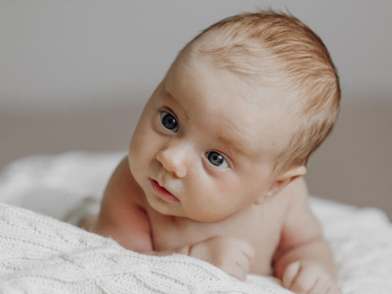 Babt med torticollis